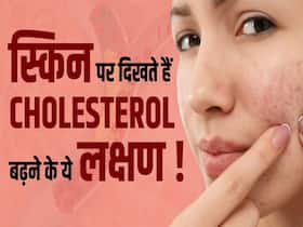 स्किन पर दिखते हैं कोलेस्ट्रॉल बढ़ने के ऐसे लक्षण, नजरअंदाज करने की ना करें गलती