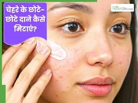चेहरे पर छोटे-छोटे दाने हो जाए तो क्या करें? जानें 3 घरेलू उपाय, जिनसे मिट जाएगी समस्या