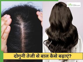 बाल तेजी से बढ़ाने के लिए क्या करें? 2 चीजों के इस्तेमाल से दोगुनी होगी ग्रोथ