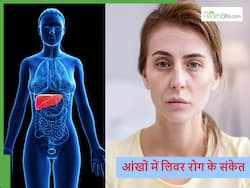 आंखों में सबसे पहले दिखते लिवर की बीमारी के ये 5 लक्षण, कहीं कराना ना पड़ जाए लिवर ट्रांसप्लांट