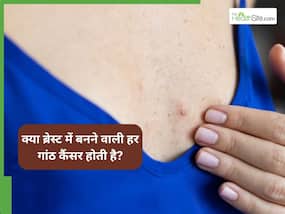 Breast Cancer Awareness : क्या ब्रेस्ट में हर गांठ कैंसर होती है? Breast Cancer Awareness : क्या ब्रेस्ट में हर गांठ कैंसर होती है?