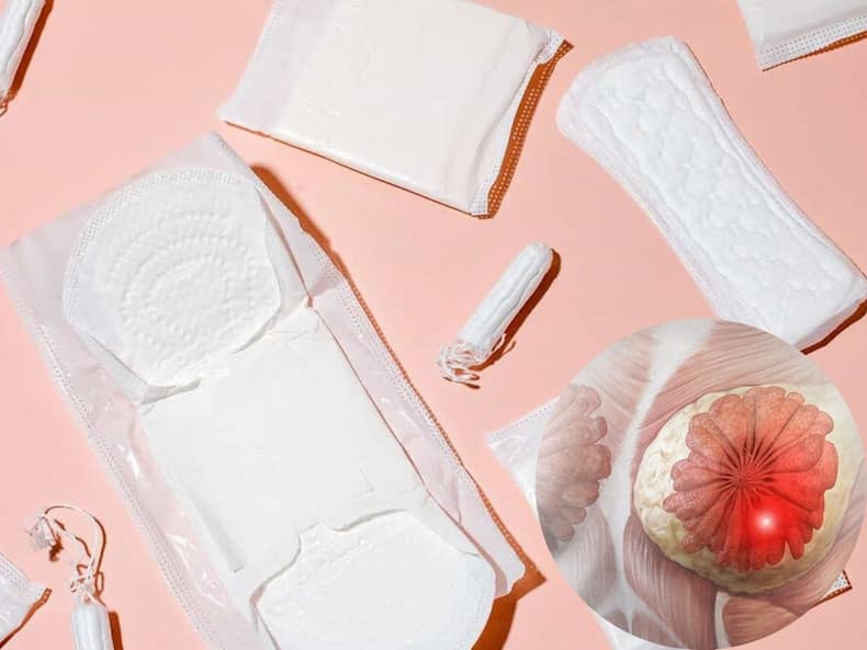 क्या पैड्स और टैम्पोन की वजह से Breast Cancer होता है?