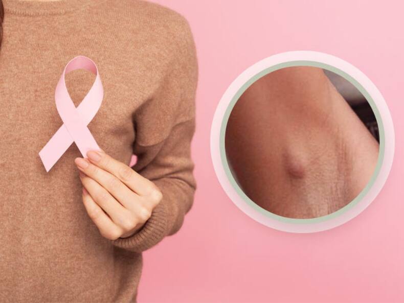 क्या पैड्स और टैम्पोन की वजह से Breast Cancer होता है?