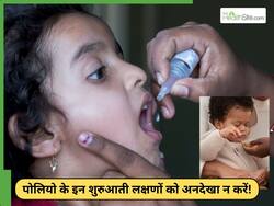 पोलियो के शुरुआती लक्षण जो अक्सर नजरअंदाज कर दिए जाते हैं