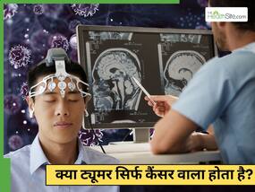 ट्यूमर कैंसर वाला है या नहीं, कैसे पता चलता है?