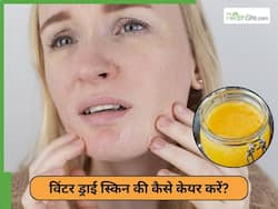 सर्दियों में नहीं फटेगी त्वचा, जानें घर पर ऐसा नुस्खा बनाना का तरीका