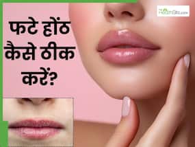सर्दियों में होंठ फट जाते हैं तो लगाएं ये 5 चीजें, नेचुरली गुलाबी बनेंगे होंठ