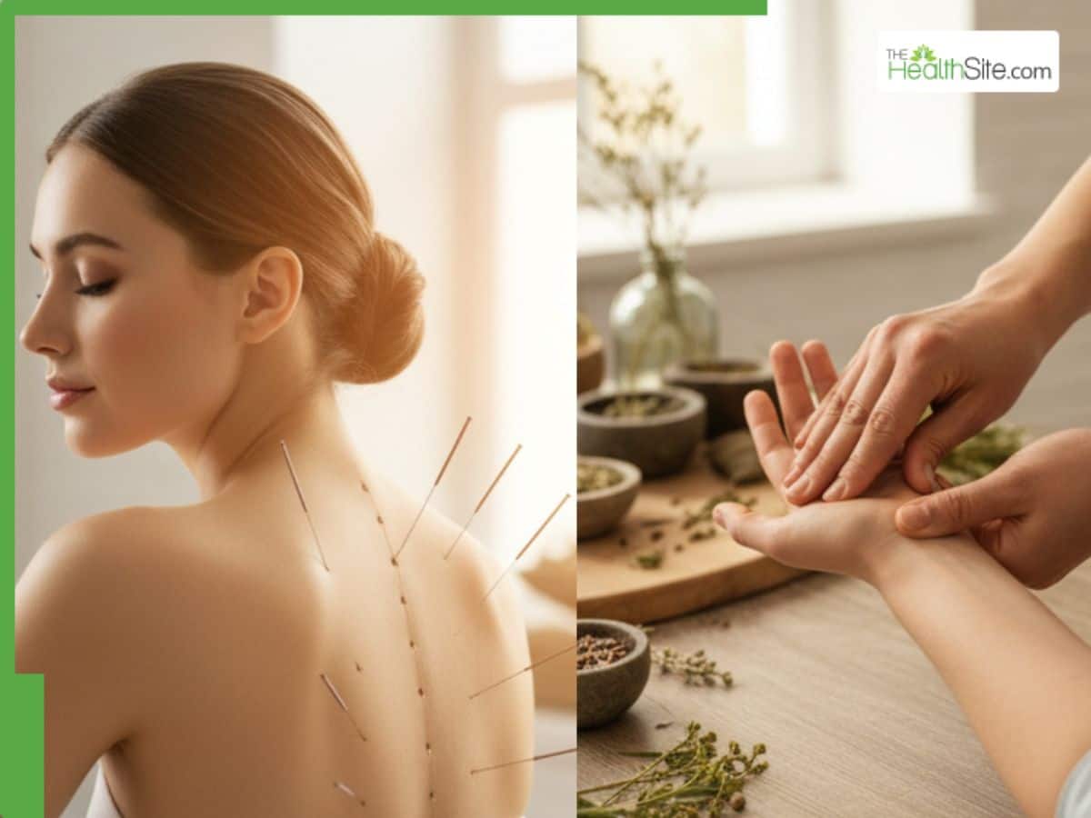 Acupuncture Day 2025: Acupuncture vs Acupressure, Which Works Better?