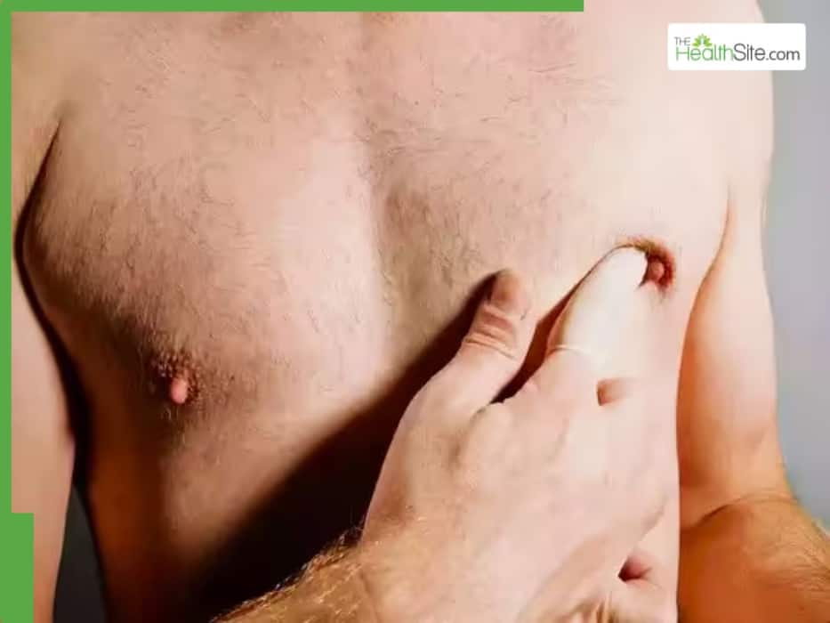 Sweet Potatoes Benefits: 7 Reasons To Eat Them Regularly