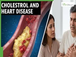 Cholesterol And Heart Disease: THIS Gene Therapy May Lower Bad LDL And Prevent Cardiovascular Risk: STUDY
