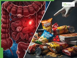 Colon Cancer Warning: Eating Ready To Eat Foods May Increase Risk, 7 Foods You Should Avoid