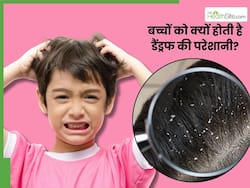 इन करणों से बच्चों को भी होने लगती है डैंड्रफ की परेशानी, जानें बचाव के उपाय