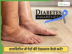 डायबिटीज में पैर की देखभाल क्यों जरूरी है? जानें खुद अपने पैरों का कैसे करें निरीक्षण और 'डायबिटिक फूट' से कैसे बचें
