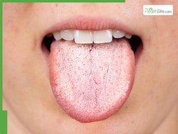 Struggling With Dry Mouth? Here   s What Causes It Causes And Home Remedies To Relieve It Naturally