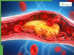 5 Heart-Healthy Superfoods That Help Lower High Cholesterol Naturally