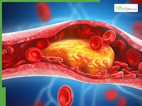 5 Heart-Healthy Superfoods That Help Lower High Cholesterol Naturally