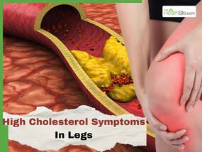 High Cholesterol Symptoms In Legs: 7 Signs of High LDL You Shouldn't Ignore