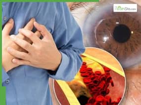 High Cholesterol Symptoms On Face: 5 Warning Signs Of High LDL You Shouldn   t Ignore