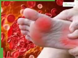 High Cholesterol Symptoms In Feet: 5 Warning Signs Of High LDL You Shouldn   t Ignore