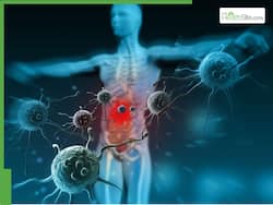 Immunity-Boosting Foods To Help Your Body Fight Off Infections This Winter