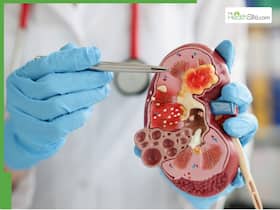 5 Everyday Medications That May Damage Kidney Function
