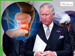 King Charles Diagnosed With Prostate Cancer: Can Treatment Help The UK Monarch Beat This Deadly Disease?