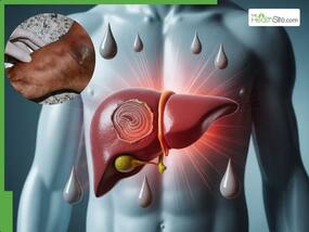 Liver Damage Symptoms In Foot: 5 Warning Signs You Should Never Ignore