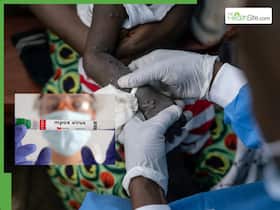 Clade Ib Mpox Cases Surge Worldwide: 17 Deaths Reported In Africa, Symptoms And Safety Measures To Know Clade Ib Mpox Cases Surge Worldwide: 17 Deaths Reported In Africa, Symptoms And Safety Measures To Know