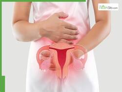 PCOS Alert: 7 Symptoms Indicating Your Condition May Be Worsening