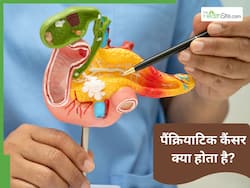 पैंक्रियाटिक कैंसर क्या होता है? इसके लक्षण और बचने के तरीके