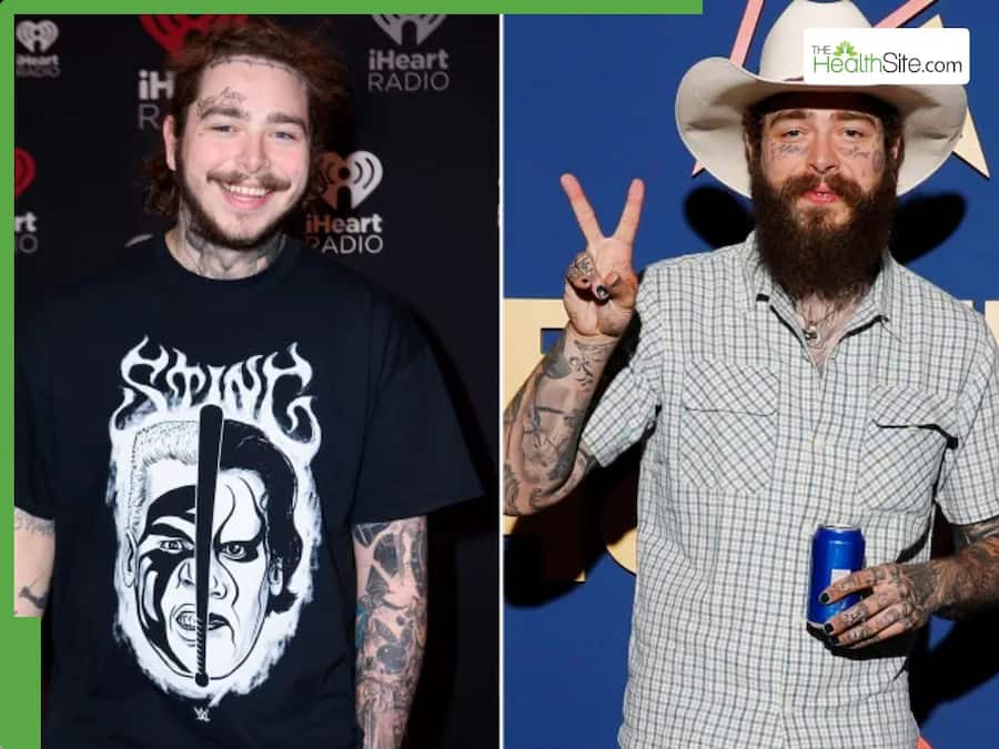 Post Malone Opens Up About His Weight Loss Journey And Overall Health
