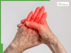 Vitamin B12 Deficiency : Common Early Indicators That You Should Not Ignore