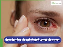 अंधा बना देगी इस विटामिन की कमी, पूर्ति के लिए आज ही खाएं ये 5 चीजें