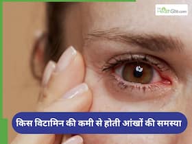 अंधा बना देगी इस विटामिन की कमी, पूर्ति के लिए आज ही खाएं ये 5 चीजें