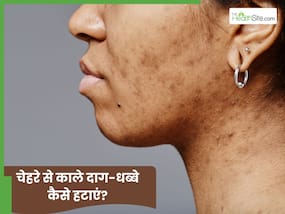 चेहरे से काले धब्बे कैसे साफ करें? जानें 5 तरीके, जो देंगे कमाल का निखार चेहरे से काले धब्बे कैसे साफ करें? जानें 5 तरीके, जो देंगे कमाल का निखार