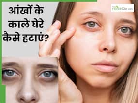 आंखों के नीचे काले घेरे हैं तो लगाएं ये 5 चीजें, धीरे-धीरे मिटने लगेंगे Dark Circles