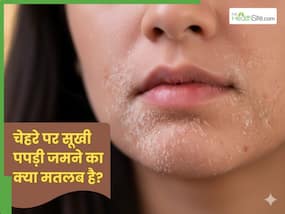 चेहरे पर सूखी पपड़ी जमने का क्या मतलब है? जान लें 5 तरीके, जो दूर करेंगे ड्राईनेस