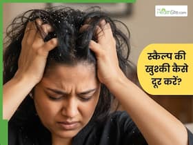 सिर में खुश्की हो जाए तो क्या करें? 5 उपाय देंगे साफ स्कैल्प, बालों को बनाएंगे हेल्दी