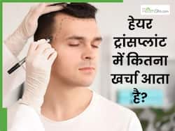 अगर आम आदमी हेयर ट्रांसप्लांट कराए तो कितना खर्चा आएगा? सस्ता कराएं या क्वालिटी चुनें?