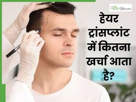 अगर आम आदमी हेयर ट्रांसप्लांट कराए तो कितना खर्चा आएगा? सस्ता कराएं या क्वालिटी चुनें?