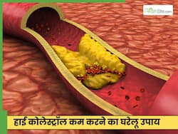 घर पर हाई कोलेस्ट्रॉल को कम करने का क्या तरीका है? जानें 5 घरेलू उपाय जो दूर करेंगे समस्या