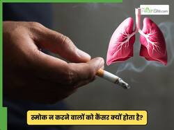 सिर्फ स्मोक करने से नहीं होता है फेफड़ों का कैंसर, एक्सपर्ट से जानें इसके लंग कैंसर होने के अन्य कारण