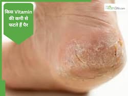 किस विटामिन की कमी से फटती हैं एड़ियां?