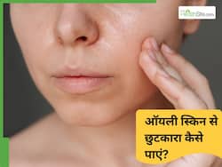चेहरे पर ज्यादा तेल होने पर क्या करें? आजमाएं 5 नुस्खे जो चेहरे की इस समस्या को करेंगे जड़ से खत्म