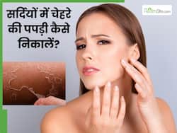 सर्दियों में चेहरे पर जम गई पपड़ी तो लगाएं ये 5 चीजें, निकल जाएगी ड्राई स्किन और त्वचा बनेगी मुलायम