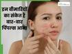 चेहरे पर बार-बार पिंपल्स निकलना सिर्फ स्किन प्रॉब्लम नहीं, शरीर इन 5 बीमारियों का भी देता है ये संकेत