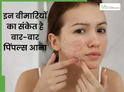 चेहरे पर बार-बार पिंपल्स निकलना सिर्फ स्किन प्रॉब्लम नहीं, शरीर इन 5 बीमारियों का भी देता है ये संकेत