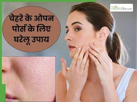चेहरे पर दिख रहे हैं गड्ढे (ओपन पोर्स)? अपनाएं ये 5 घरेलू उपाय, स्किन पर आएगा कसाव
