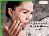 चेहरे के दाग-धब्बे मिटाने के लिए क्या लगाना चाहिए? ये 5 घरेलू नुस्खे हैं बेहद असरदार