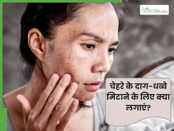 चेहरे के दाग-धब्बे मिटाने के लिए क्या लगाना चाहिए? ये 5 घरेलू नुस्खे हैं बेहद असरदार